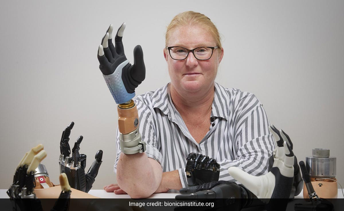 Swedish Woman With Bionic Hand Regains 80% Function And Sense Of Touch