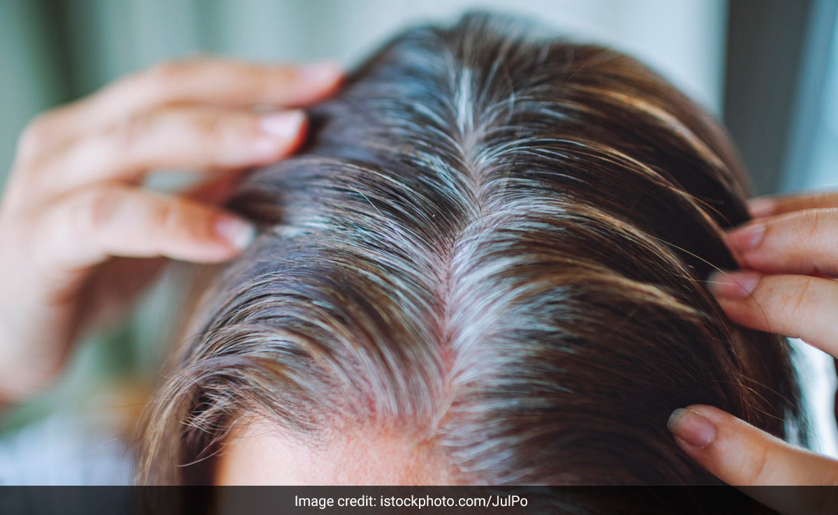 सफेद बालों को एक या 2 नहीं बल्कि रसोई की ये 5 चीजें कर सकती हैं काला, जान लीजिए कैसे करें इस्तेमाल