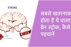 World Stroke Day 2023 | सबसे खतरनाक होता है ये वाला ब्रेन स्ट्रोक, कैसे पहचानें World Stroke Day 2023 | सबसे खतरनाक होता है ये वाला ब्रेन स्ट्रोक, कैसे पहचानें
