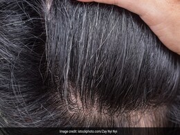 सफेद बालों को फिर से काला बना देती हैं घर की ये 3 चीजें, कलौंजी भी आती है काम सफेद बालों को फिर से काला बना देती हैं घर की ये 3 चीजें, कलौंजी भी आती है काम