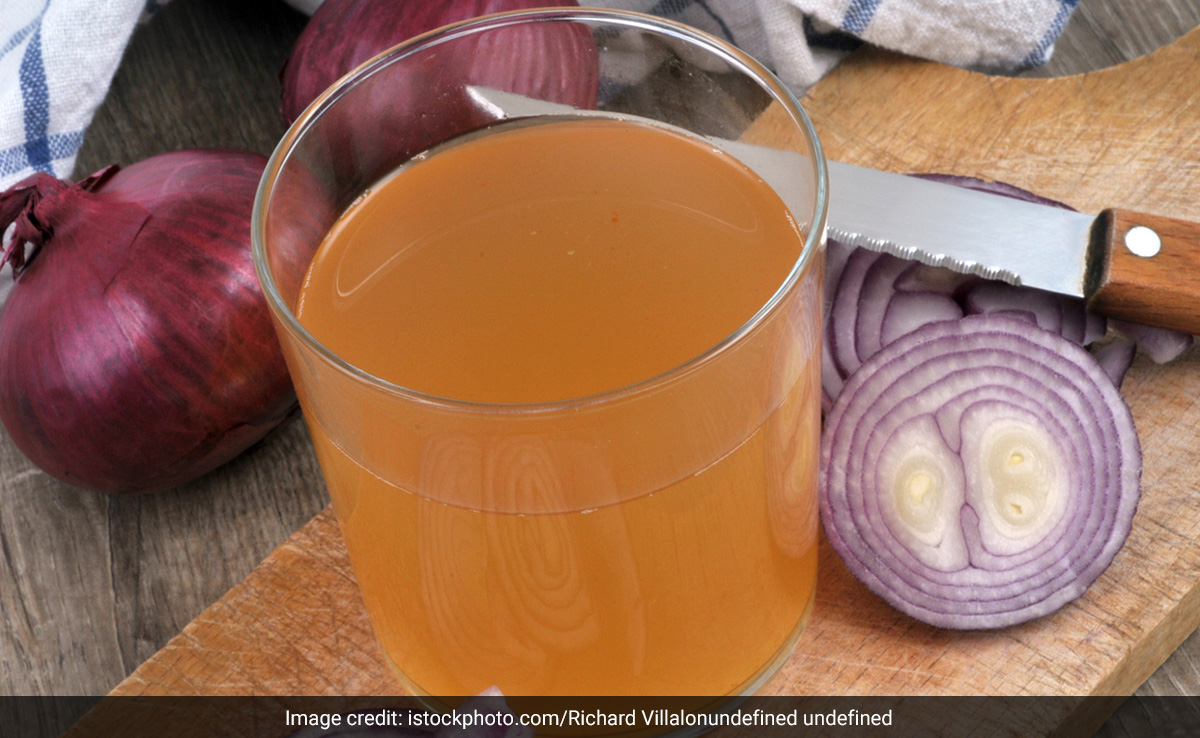 Onion Price: प्याज के बढ़ते दामों से निकल रहा है दम? खाने में ट्राई करें ये चीजें