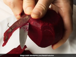 Beetroot side effects : फायदे ही नहीं चुकंदर खाने के हैं कुछ बड़े नुकसान भी हैं Beetroot side effects : फायदे ही नहीं चुकंदर खाने के हैं कुछ बड़े नुकसान भी हैं