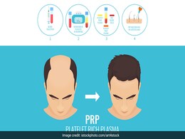 बालों का झड़ना परमानेंट रोक देता है प्लेटलेट्स रिच प्लाज्मा इंजेक्शन (PRP)? जानें क्या है, कैसे कराते हैं और इसके संभावित साइड इफेक्ट बालों का झड़ना परमानेंट रोक देता है प्लेटलेट्स रिच प्लाज्मा इंजेक्शन (PRP)? जानें क्या है, कैसे कराते हैं और इसके संभावित साइड इफेक्ट