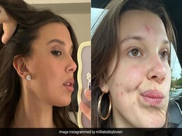 In Her Latest Bare Face Selfie, Millie Bobby Brown Is Normalising Acne With Her Makeup-Free Photo In Her Latest Bare Face Selfie, Millie Bobby Brown Is Normalising Acne With Her Makeup-Free Photo