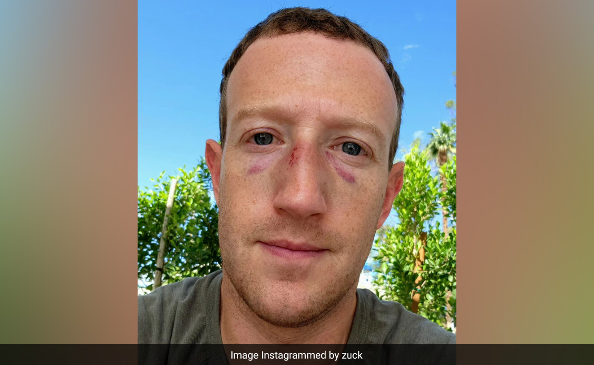 Mark Zuckerberg Shares Selfie With Black Eyes: "Sparring Got A Little Out Of Hand"