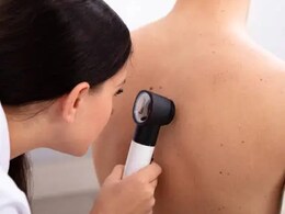 मस्से समझकर न करें अवॉयड, हो सकते हैं कैंसर के संकेत, स्किन कैंसर के 10 आम लक्षण मस्से समझकर न करें अवॉयड, हो सकते हैं कैंसर के संकेत, स्किन कैंसर के 10 आम लक्षण