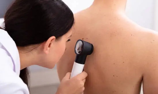 Kiran Sethi urges viewers to self-check their moles every month or visit a doctor every 6 months