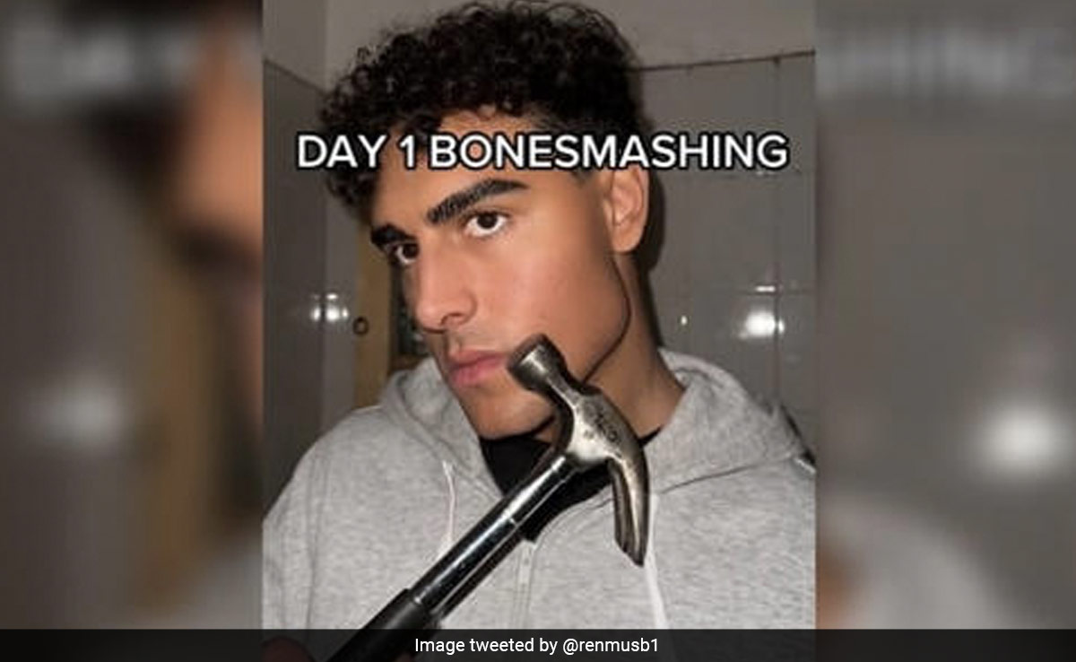 Bizarre 'Bone Smashing' Trend Makes People Hit Their Faces, Here's Why