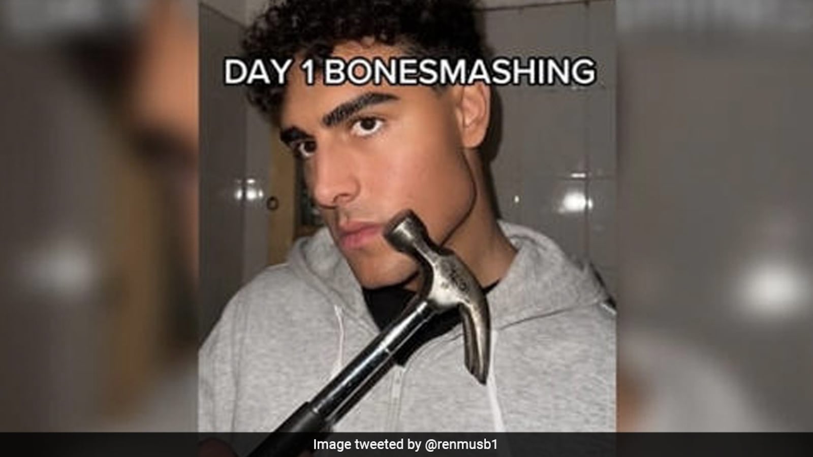 Bizarre 'Bone Smashing' Trend Makes People Hit Their Faces, Here's Why
