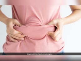 Flat Tummy Exercise: C-सेक्शन डिलिव्हरीनंतर सुटलेले पोट लगेचच जाईल आत, फॉलो करा 5 टिप्स Flat Tummy Exercise: C-सेक्शन डिलिव्हरीनंतर सुटलेले पोट लगेचच जाईल आत, फॉलो करा 5 टिप्स
