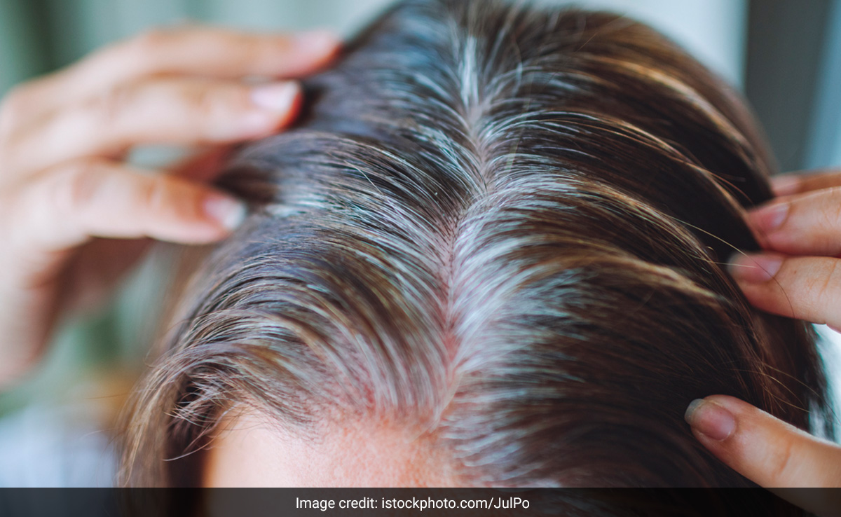 बाल सफेद हो गए हैं तो इन 3 में से बस एक हेयर मास्क लगाकर देख लीजिए, काले हो जाएंगे White Hair 