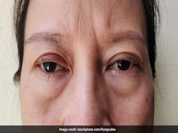 Facial Swelling: सुबह उठने पर सूजा-सूजा नजर आता है चेहरा, ये हो सकती है वजह, इन घरेलू उपायों से मिलेगी राहत Facial Swelling: सुबह उठने पर सूजा-सूजा नजर आता है चेहरा, ये हो सकती है वजह, इन घरेलू उपायों से मिलेगी राहत