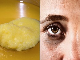 डार्क सर्कल्स कम करने के लिए घी में मिलाकर लगा लीजिए यह एक चीज, हट जाएंगे काले निशान डार्क सर्कल्स कम करने के लिए घी में मिलाकर लगा लीजिए यह एक चीज, हट जाएंगे काले निशान