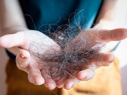 Home remedy in hair fall : इस तरीके से बाल में लगाइए दही, नहीं झड़ेंगे बाल बनी रहेगी चमक Home remedy in hair fall : इस तरीके से बाल में लगाइए दही, नहीं झड़ेंगे बाल बनी रहेगी चमक