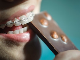 Wearing Braces? Keep Your Smile Intact By Saying No To These 5 Foods Wearing Braces? Keep Your Smile Intact By Saying No To These 5 Foods