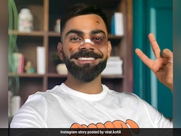 "Should See The Other...": Virat Kohli 'Beaten Up' Instagram Story Viral. Internet Reacts "Should See The Other...": Virat Kohli 'Beaten Up' Instagram Story Viral. Internet Reacts