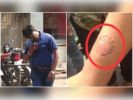 Ratlam News: सड़क पर अजीबोगरीब हरकत करने लगा ASI, लोगों ने समझाया तो काट खाया हाथ 