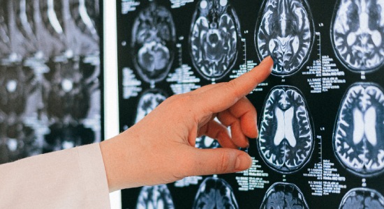 Scientists Hack The Brain, Recalling Specific Memories With Prosthetics
