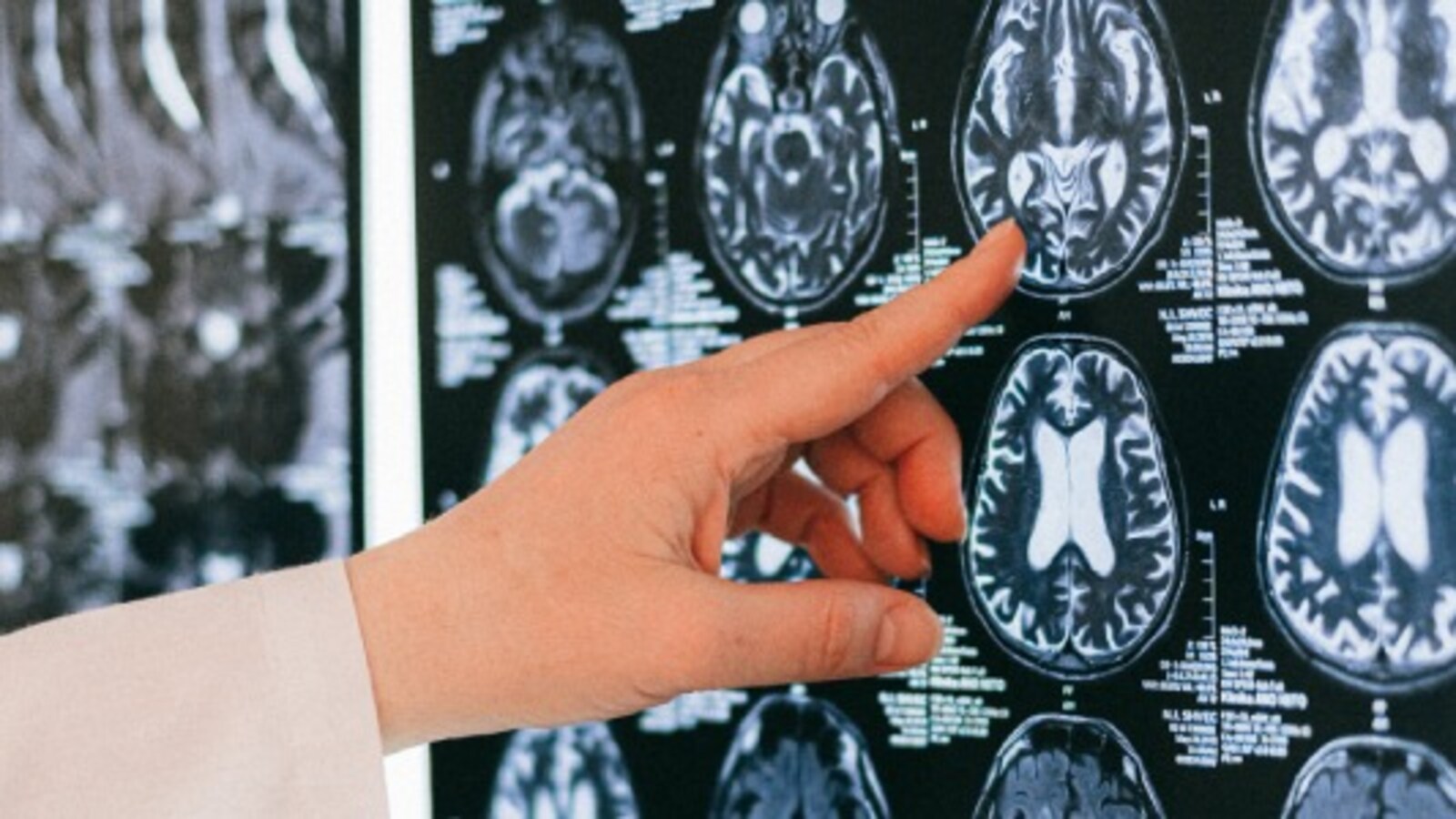 Scientists Hack The Brain, Recalling Specific Memories With Prosthetics