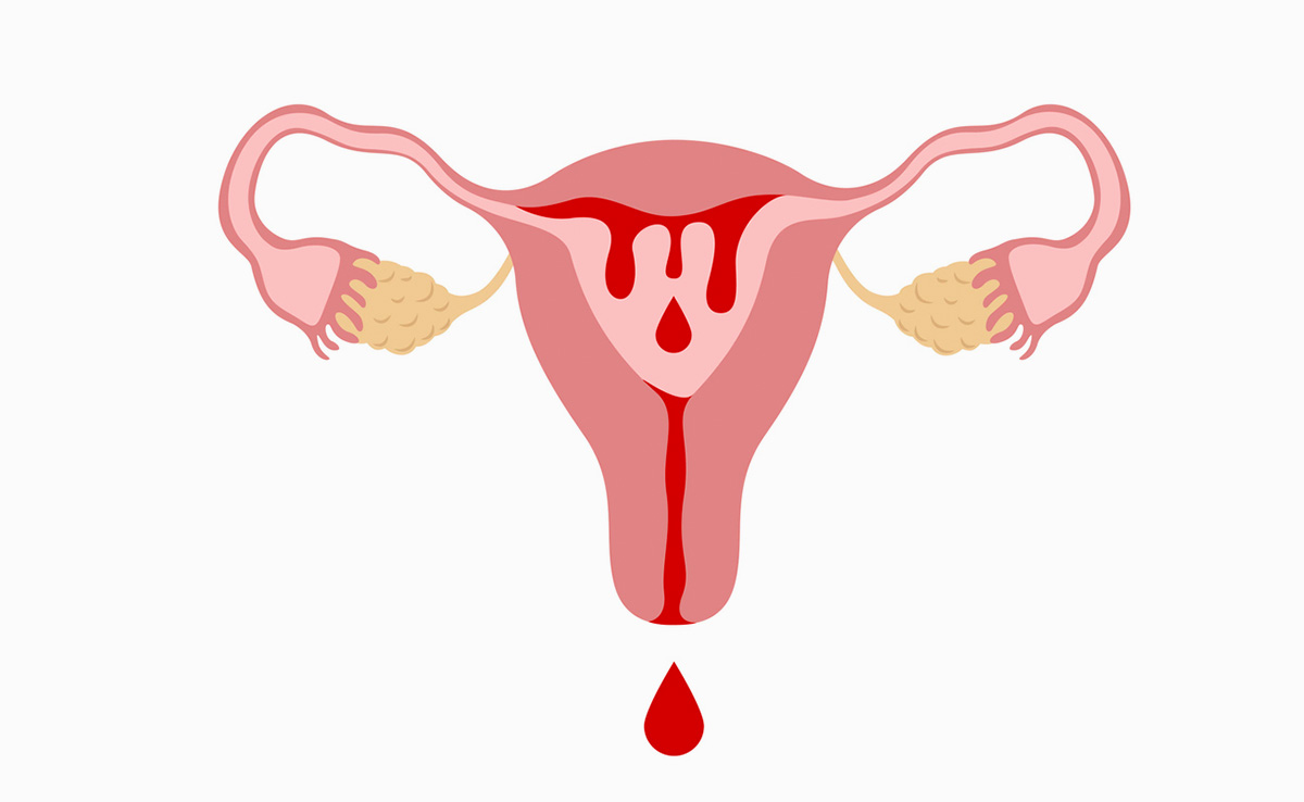 Brown Discharge in Pregnancy: क्या प्रेगनेंसी में ब्राउन डिस्चार्ज होना सामान्य है? यह मिसकैरेज का है संकेत या कुछ और, जानें