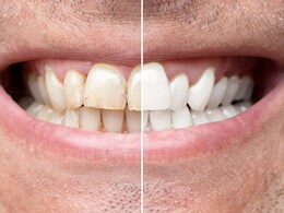 Oral care tips : ऐसे रखिए दांतों का ख्याल नहीं पड़ेगी कभी डेंटिस्ट के पास जाने की जरूरत