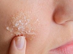 ड्राई स्किन को दूर करने के लिए क्या खाना चाहिए? किचन में मौजूद ये चीजें कर सकती हैं जादू Recipe