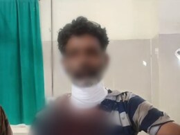 MP News: पतंग उड़ाने वाली चाइना डोर से कटा युवक का गला, बैन के बाद भी धड़ल्ले से बिक रहा मांझा