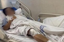 "Saw Him With Wife For First Time That Day": Woman Hit By Lover's Car "Saw Him With Wife For First Time That Day": Woman Hit By Lover's Car