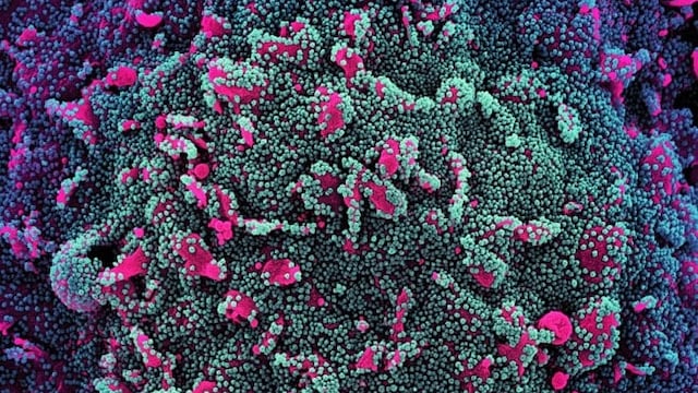 The JN.1 variant can contribute to minor gastrointestinal problems