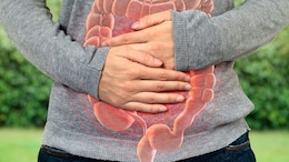 5 Eating Habits That Cause Inflammation. Stop Now!