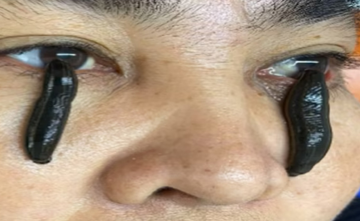 आंखों के इलाज का ये तरीका देख हैरत में पड़े लोग, कहा- कहीं लेने के देने ना पड़ जाए आंखों के इलाज का ये तरीका देख हैरत में पड़े लोग, कहा- कहीं लेने के देने ना पड़ जाए