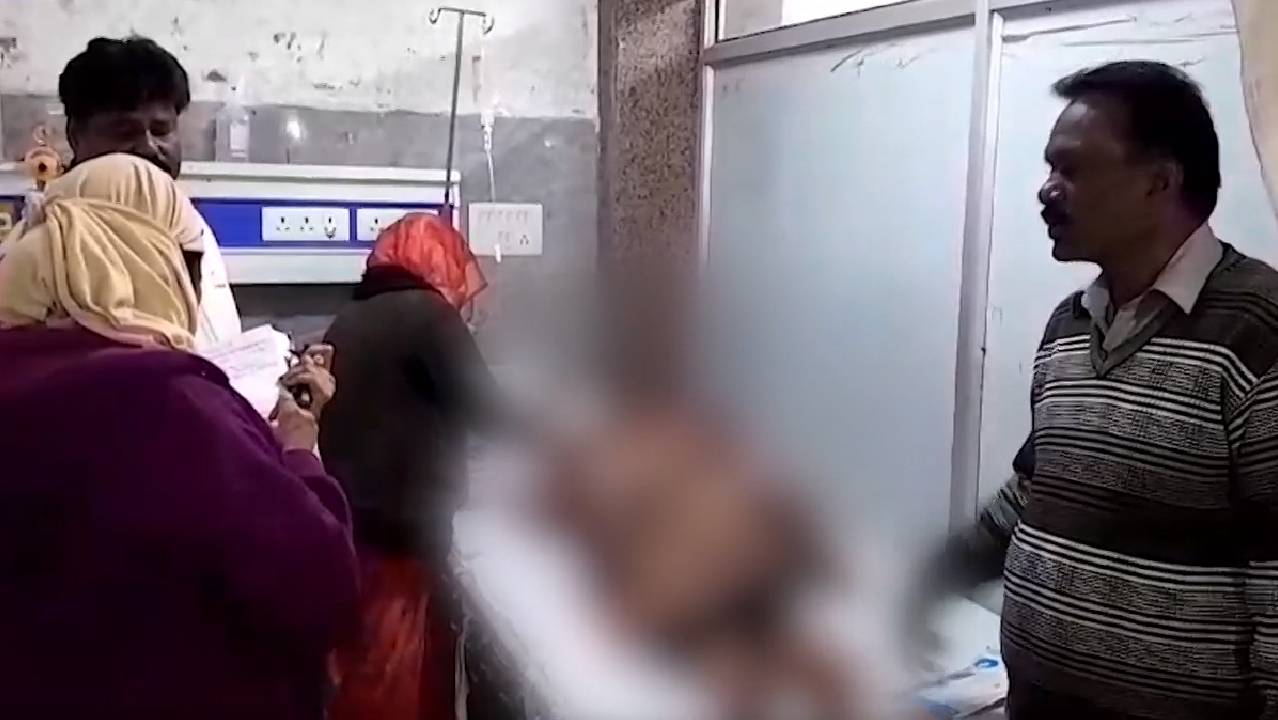 नाकाम आशिक ने घर में घुस कर लड़की पर किया एसिड से हमला