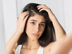 डैंड्रफ से कैसे छुटकारा पाएं? इन घरेलू उपायों को बनाएं साथ और फिर देखें कमाल