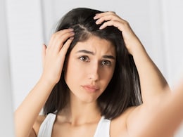 डैंड्रफ से कैसे छुटकारा पाएं? इन घरेलू उपायों को बनाएं साथ और फिर देखें कमाल