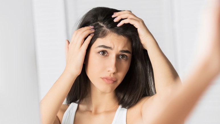 डैंड्रफ से कैसे छुटकारा पाएं? इन घरेलू उपायों को बनाएं साथ और फिर देखें कमाल