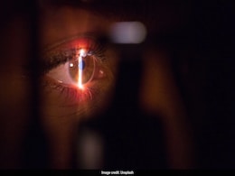 Doctors In China Remove 60 Live Worms From Woman's Eyes Doctors In China Remove 60 Live Worms From Woman's Eyes