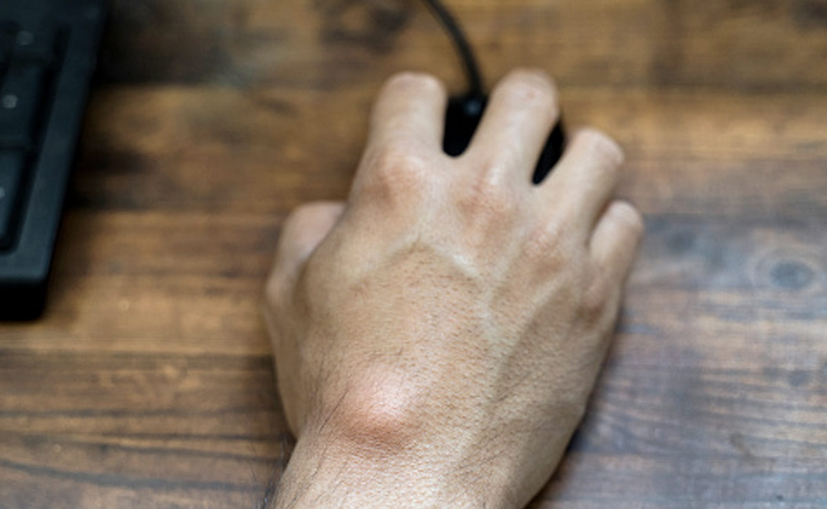 हाथ और पैर की मांसपेशियों में बनने लगे गांठ तो करे ये घरेलू उपाय, गल जाएंगे Lumps