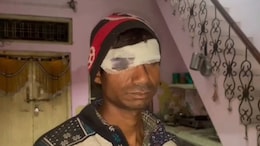 UP Man Asks For Wife's Phone, She Stabs Him In The Eye With Scissors