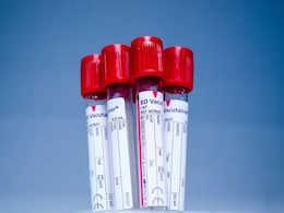 Sickle Cell Anemia Awareness Day: Why Fighting Stigma Is As Important As Treatment