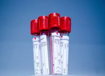 Sickle Cell Anemia Awareness Day: Why Fighting Stigma Is As Important As Treatment