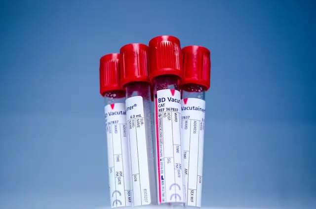 World Sickle Cell Awareness Day Highlights Critical Misconceptions