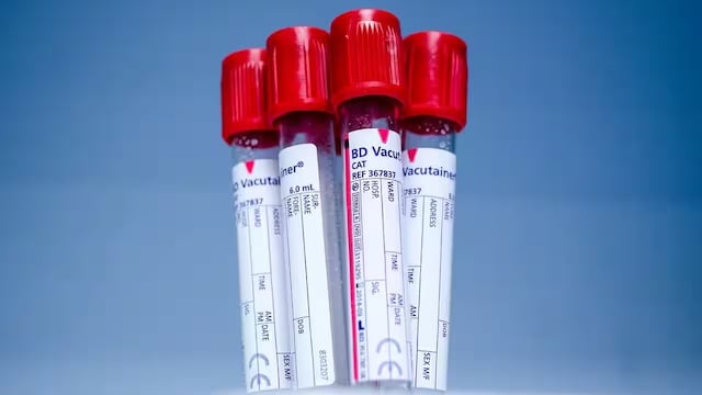 Sickle Cell Anemia Awareness Day: Why Fighting Stigma Is As Important As Treatment