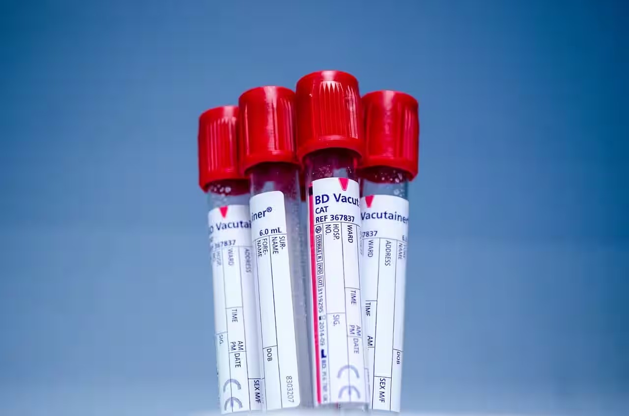 Sickle Cell Anemia Awareness Day: Why Fighting Stigma Is As Important As Treatment