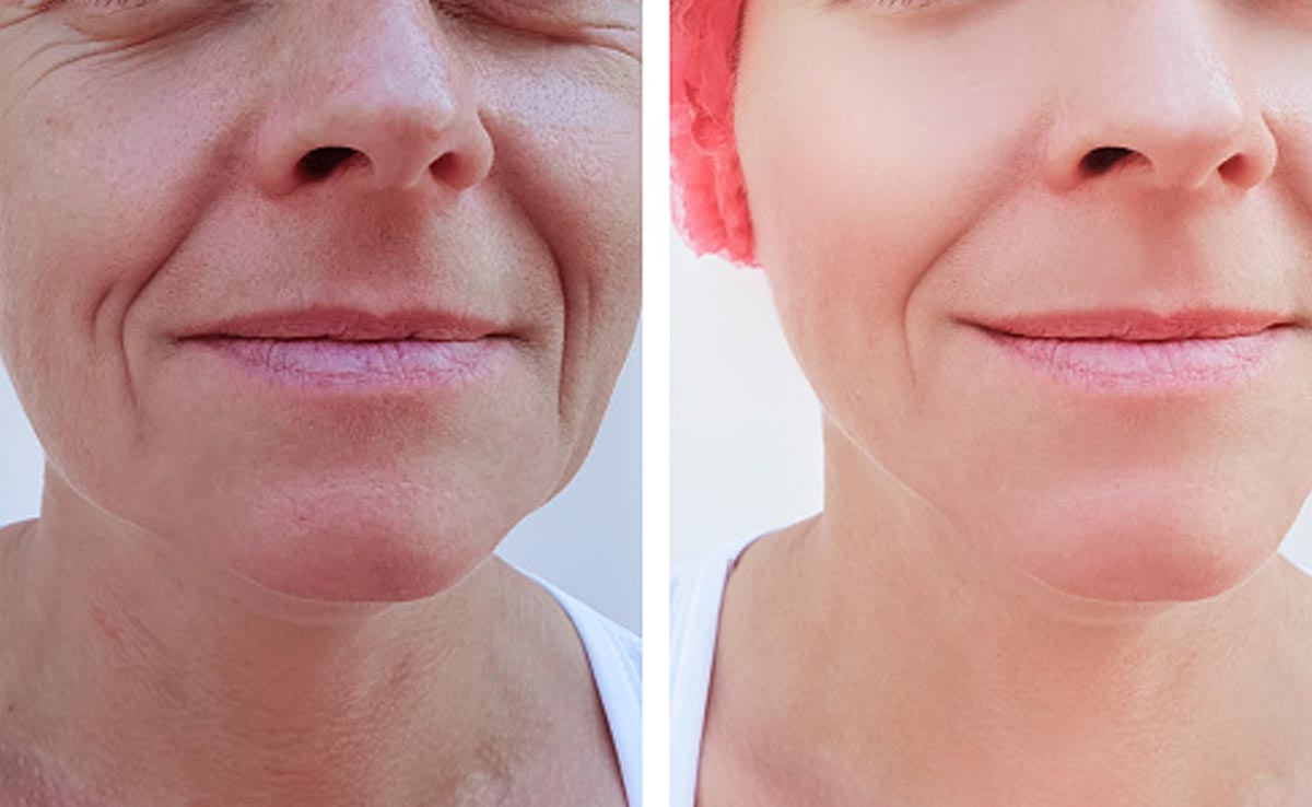 यंग दिखना है तो हाइड्रोजन थेरेपी कर देगी आपके इस सपने को पूरा, रिसर्च में आया यह चौंका देने वाला फॉर्म्युला