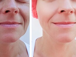 50 साल की उम्र में 25 की दिखना चाहती हैं तो आज से ये खाना शुरू कर दीजिए, फिर चेहरे पर झुर्रियां नहीं आएंगी कभी 50 साल की उम्र में 25 की दिखना चाहती हैं तो आज से ये खाना शुरू कर दीजिए, फिर चेहरे पर झुर्रियां नहीं आएंगी कभी