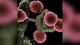 Vibrating Molecules in Lab Experiment Wipe Out 99% Of Cancer Cells
