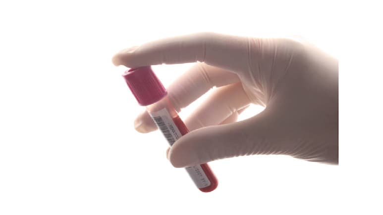 5 Blood Tests Every Woman Needs To Track For Real Health Insights: Nutritionist