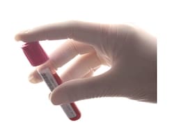5 Blood Tests Every Woman Needs To Track For Real Health Insights: Nutritionist 5 Blood Tests Every Woman Needs To Track For Real Health Insights: Nutritionist