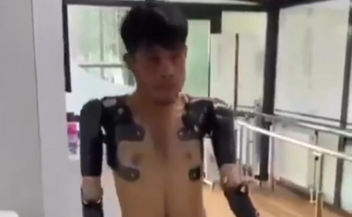 कमाल के हैं आर्टिफिशियल हैंड्स, बॉडी सूट की तरह पहन रहा शख्स, वीडियो देख विज्ञान को सलाम कर रहे लोग