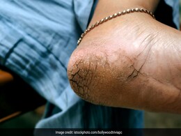 तलवों पर जमी गंदगी और डेड स्किन सेल्स हटाएगा यह स्क्रब, खुद बनाकर साफ कर सकती हैं पैर तलवों पर जमी गंदगी और डेड स्किन सेल्स हटाएगा यह स्क्रब, खुद बनाकर साफ कर सकती हैं पैर